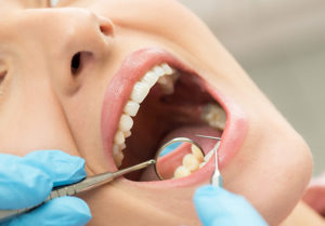 Non-Surgical Periodontal Treatment