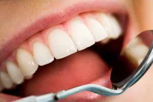 Comparing Dental Implants & Dentures
